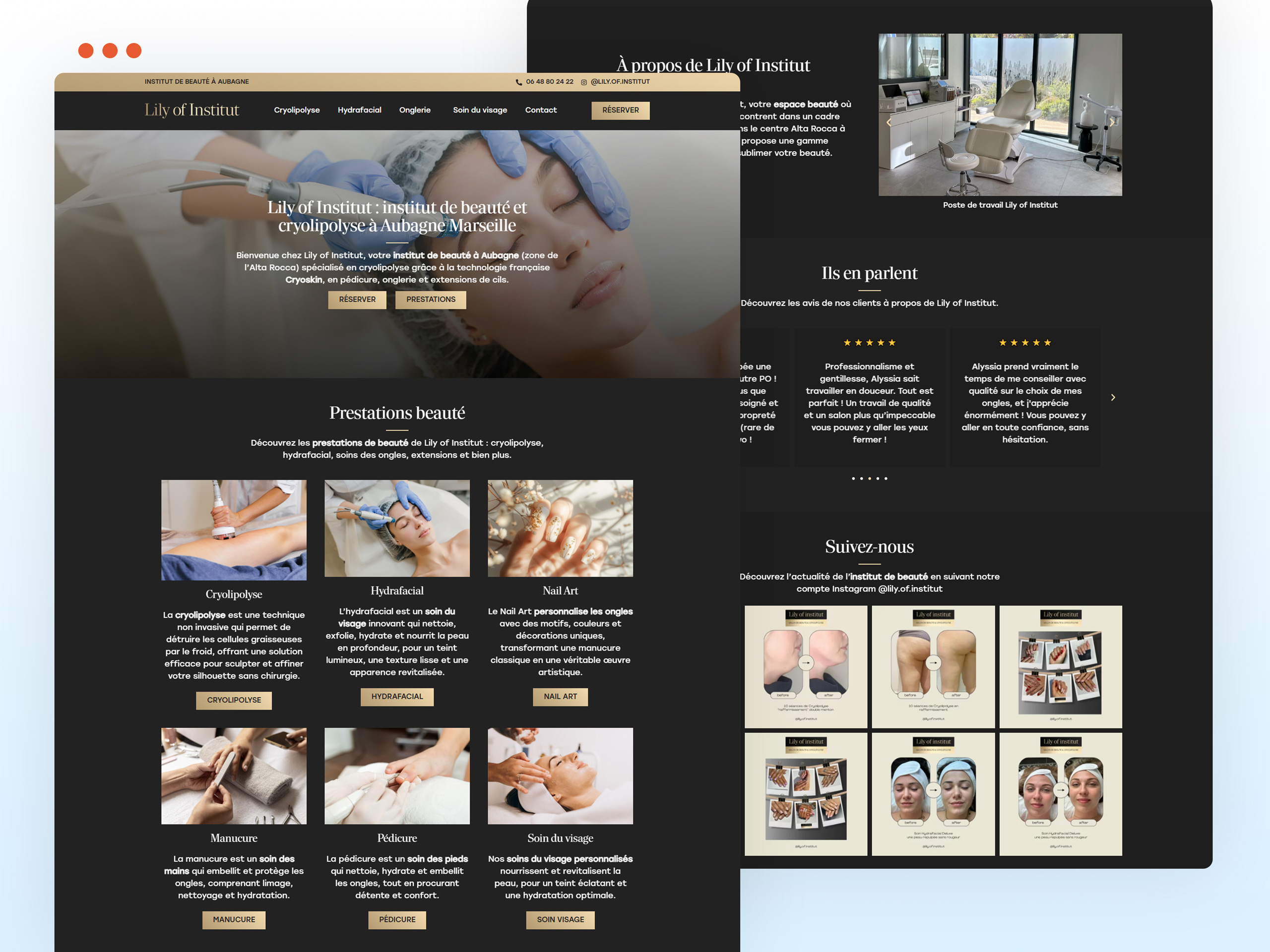 Institut de beauté Lily of Institut : cryolipolyse, hydrafacial, manucure, pédicure